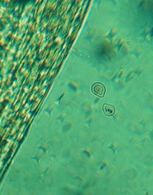 Microscopic view of algae and water under a microscope