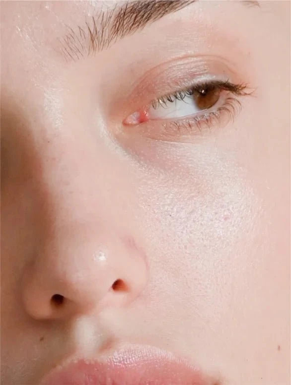 Close-up of a person's eye with visible skin texture