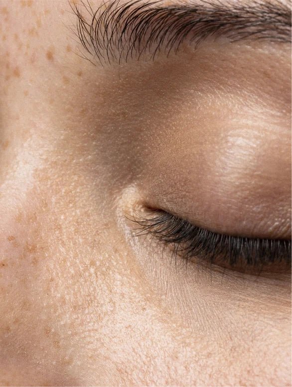 Close-up of a person's eye with visible skin texture