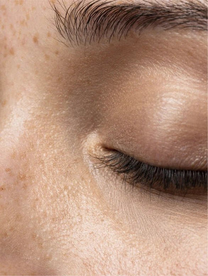 Close-up of a person's eye with visible skin texture